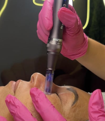 a woman getting a facial lift in a beauty salon