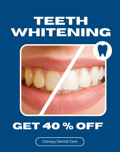 teeth whitening in baner