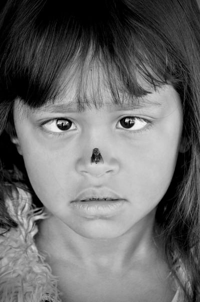 Peter Pickering's lens captures a rare moment as a fly lands on a child's nose sending her crosseyed