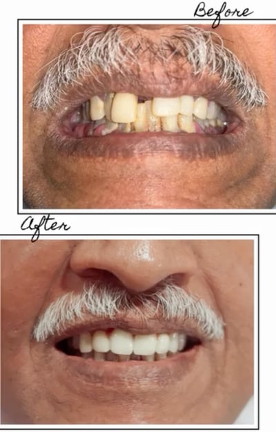 Dentist in Bangalore