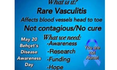 vasculitis