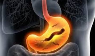 The Impact of Microbiome, Fasting, and Probiotics on Cancer (4)