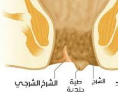 Analgesic properties: Honey relieves pain and itching associated with fissures and fistulas