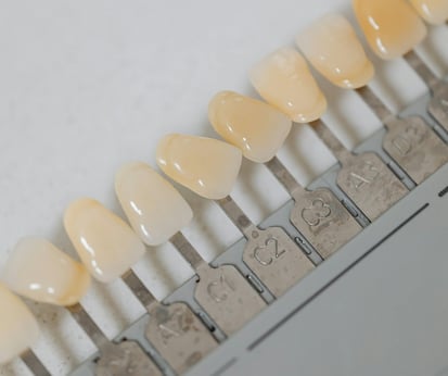 Shade Guide Gigi untuk Whitening