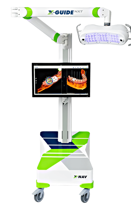 X-Nav X-Guide Surgical Navigation Machine