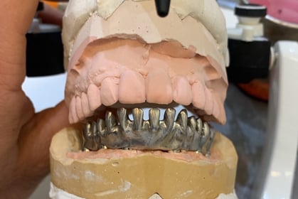 Procad Henares, prueba de metal rehabilitación inferior