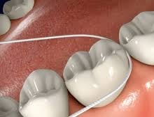 dental floss forming 'C' shape around the tooth