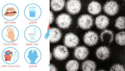 وخاصة الرضع، يمكن أن يؤدي الإسهال إلى الجفاف بسرعة