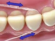 dental floss sliding motion to clean between the teeth