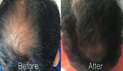 Before and After