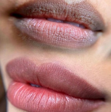 Neutralización de labios