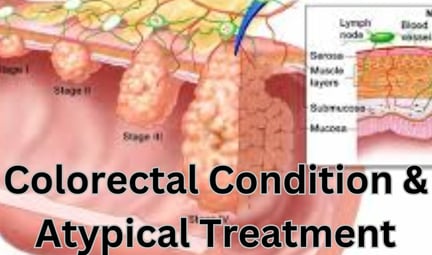 Bleeding Per Rectum Rectal bleeding