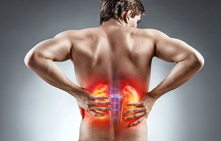 kidney stone pain