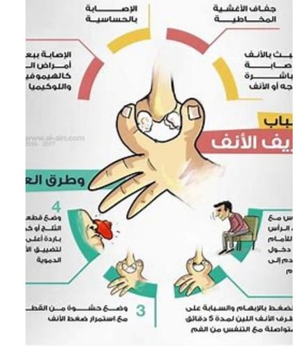 الاسباب