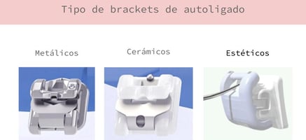 brackets