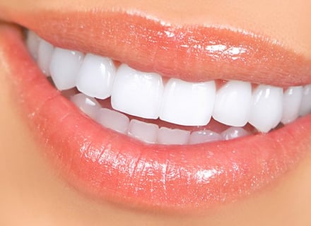 dentes brancos