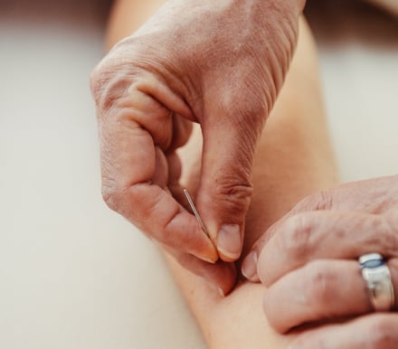 stimulation des méridiens