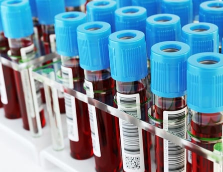 Serum kalsiyum testi, kemik, kas ve sinir sağlığını değerlendirmek için yapılan bir kan testidir.
