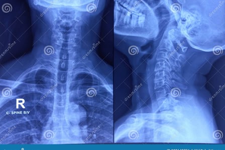 a x - ray of a skeleton in a medical device
