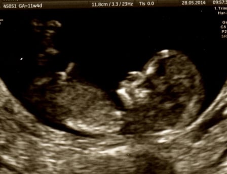 ultrasound image copyrighted