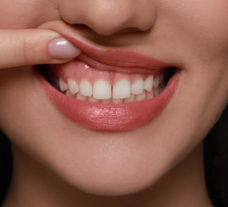 Periodontology - the discipline that cares for your gums