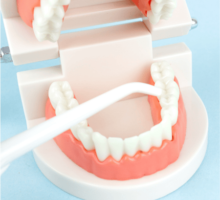 Removable dental prosthesis