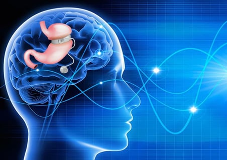 Pose d'anneau gastrique virtuel-mental en hypnose à Lyon : un protocole non-invasif