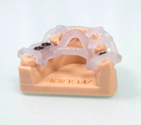 Precio de implantes dentales en sevilla