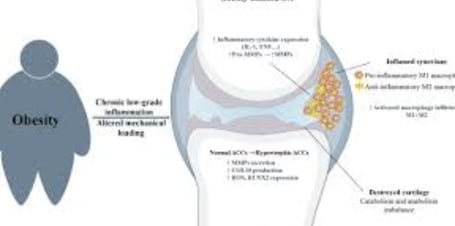 obesity damage the cartilage
