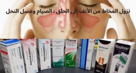 بخاخات الأنف الستيرويدية، والستيرويدات الفموية، ومضادات الاحتقان، ومضادات الهيستامين، والمعالجة المن