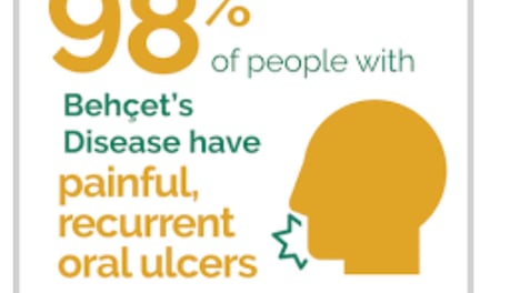 98% painful recurrent oral ulcers