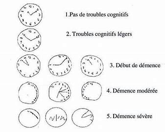 Détections des troubles cognitifs