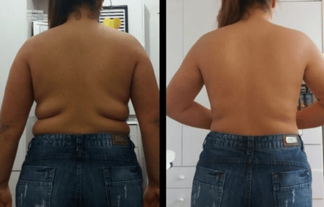 mulher mostrando fotos de antes e depois do seu emagrecimento