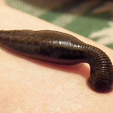 Leech Chikitsa