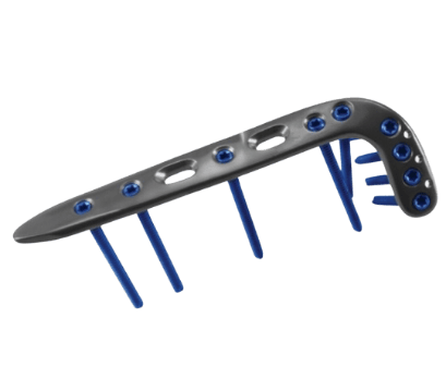 Placa para Tibia Distal Lateral