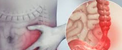 medication side effects, changes in diet, irritable bowel syndrome (IBS), or more severe conditions