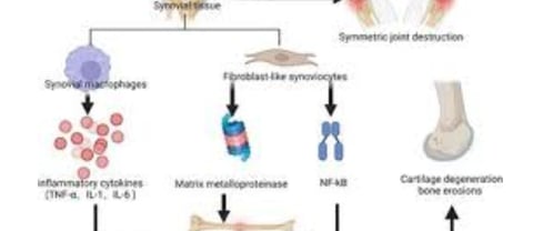 retinitis pigmentosa treatment1