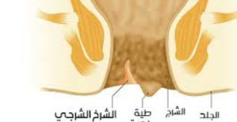 الشرخ الشرجى