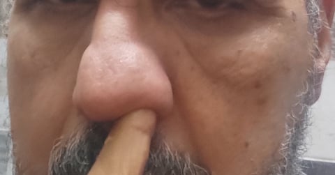 علاج الانف