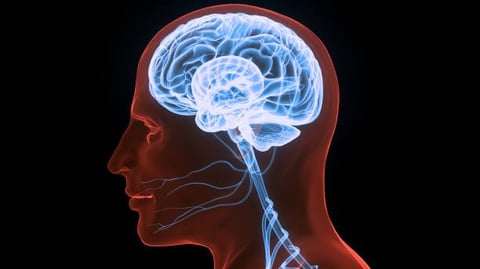 a brain scantroot of a brain scanmap