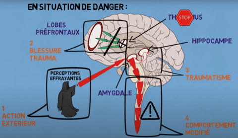 Julien Renault IFS Centre - traumas conséquences cerveau - symptomes traumatisme