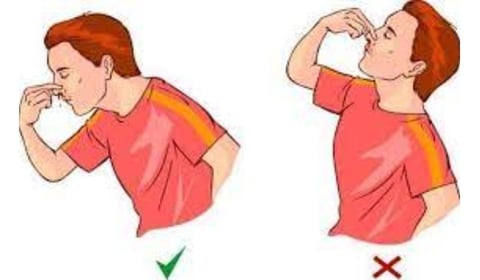 الطريقه الصحيحة وقف النزيف
