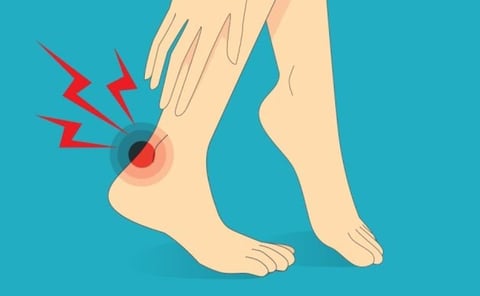 Effective Ankle Sprain Treatment Options physical therapy
