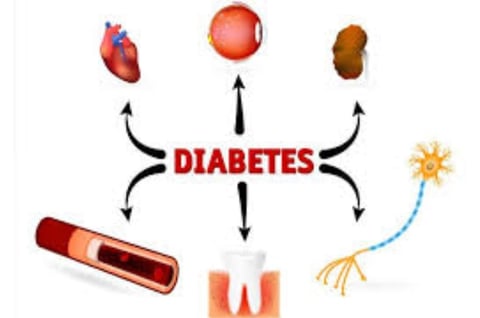 a diagram of a diagram of the different types of diabetes