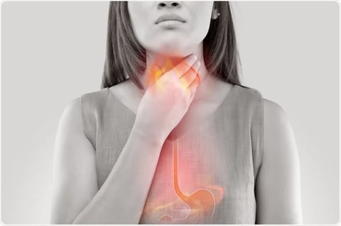heartburn-and-acid-reflux