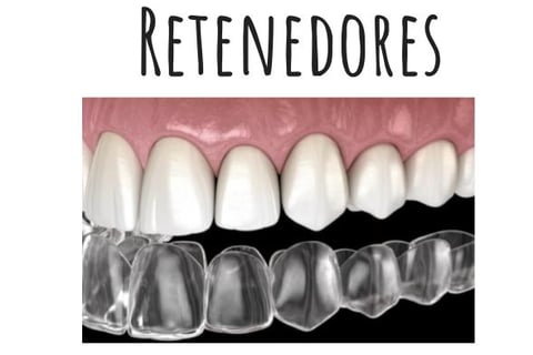 retenedores dentales