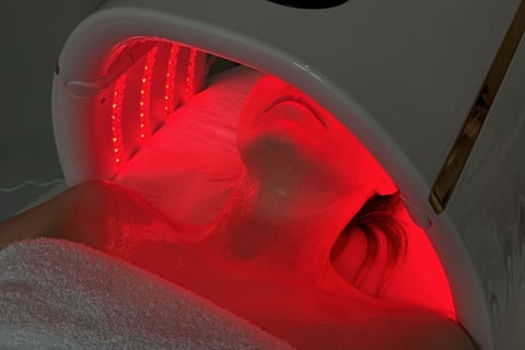 Oxygen Carboxy Therapy – Karboksyterapia