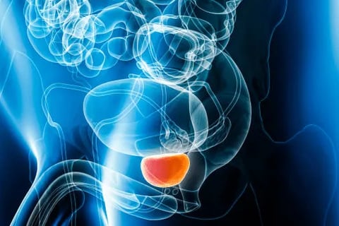 ecografia vescica prostata svuotamento vescicoprostatica