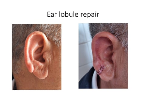 Hanging ear Large ear hole