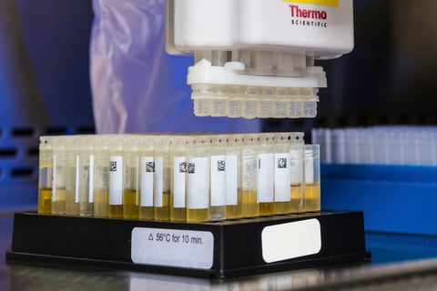 Malta drug test urine test